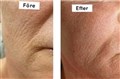 0 a  fractional_rf_leilasspa 1.jpg