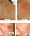 0 a plasmage pigment   leilasspa.jpg