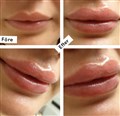 0 a russan lips leilasspa 6.jpeg