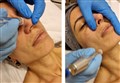 0 d microdermabrasion leilasspa.jpg