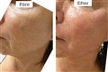 0 fr + microgold leilasspa.jpg