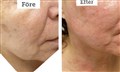 0 fr + microgold leilasspa 3.jpg