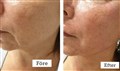 0 fractional rf leilasspa 13.jpg