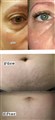 0 fractional rf leilasspa 23.jpeg