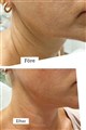 0 fractional rf leilasspa 5.jpeg