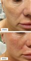 0 fractional rf leilasspa 6.jpeg