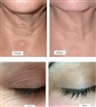 0 fractional rf leilasspa b.jpg