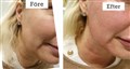 0 fractional rf leilasspa j 1.jpg