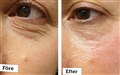 0 kombinations leilasspa   prx - 33 t + rf  sa 1.jpeg