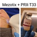 0 mezotix behandling med prxt33  leilasspa.jpg