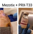 0 mezotix behandling med prxt33  leilasspa  1.jpeg