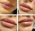0 russen lips leilasspa ,  hy.jpg