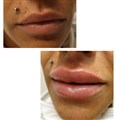 0 russen lips leilasspa ,  stylage ,.jpg