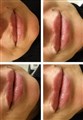0 russen lips leilasspa  filorga a--.jpeg
