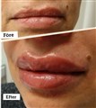 0 russian lips leilasspa stylage  ,1.jpg