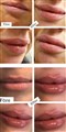 0 russin lips leilasspa h.jpeg