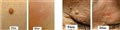 plasmage__behaandling_leilasspa__11.jpg